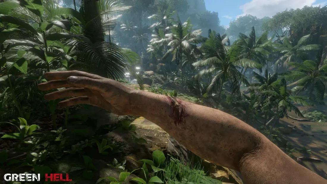 An image showing an injury in Green Hell. - This Brutal Survival Hit Is Currently 90 Percent Off on Steam
